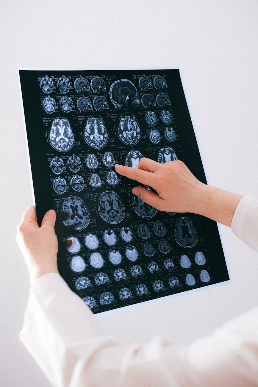 Consultații neurologice gratuite la SJU Târgu Jiu. Ce simptome nu trebuie ignorate